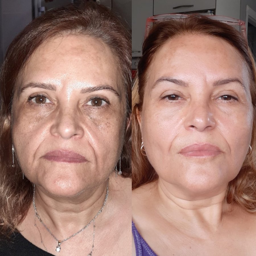 Gerçek kullanıcı öncesi ve sonrası