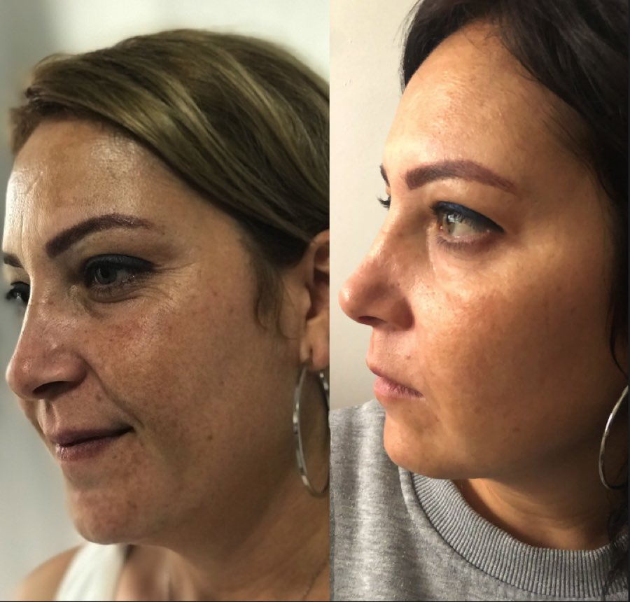 Gerçek kullanıcı öncesi ve sonrası